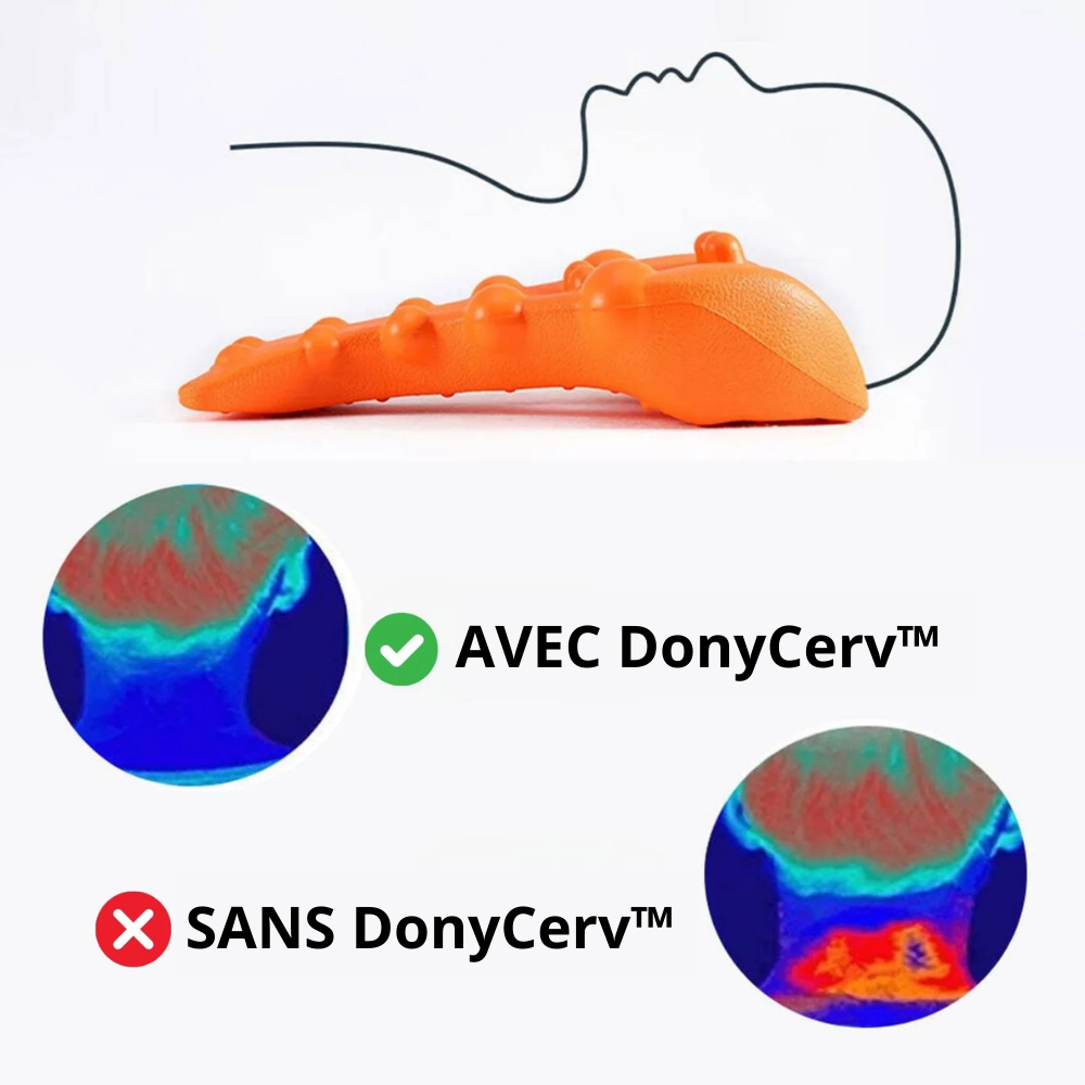 DonyCerv™ - Relâchement des points de tension